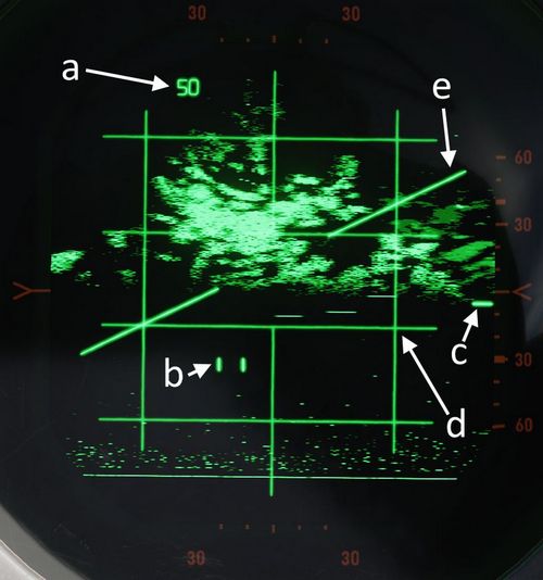 radar_screen